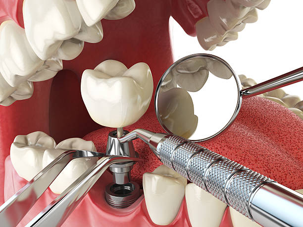 Best Same-Day Emergency Dental Services in Wyanet, IL