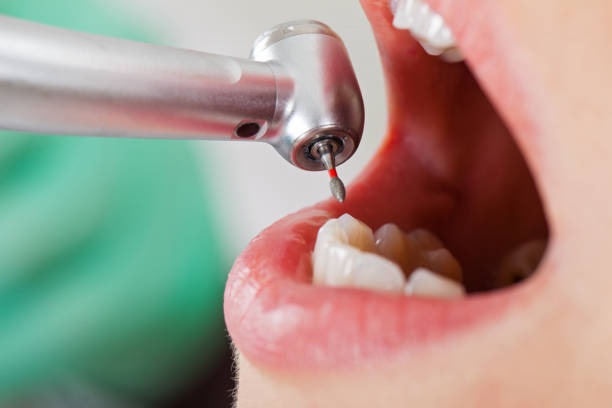 Best Emergency Dental Care for Broken or Chipped Teeth in Wyanet, IL